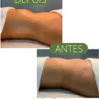 Imagem 4 da empresa NADIA DUARTE MASSOTERAPEUTA FORTALEZA Massoterapia em Fortaleza CE