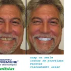 Imagem 6 da empresa ODONTO PREMIERE CLÍNICA ODONTOLÓGICA Dentista - Periodontia em Osasco SP