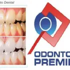 Imagem 7 da empresa ODONTO PREMIERE CLÍNICA ODONTOLÓGICA Dentista - Periodontia em Osasco SP