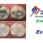 Imagem 2 da empresa ODONTO PREMIERE CLÍNICA ODONTOLÓGICA Dentista - Periodontia em Osasco SP