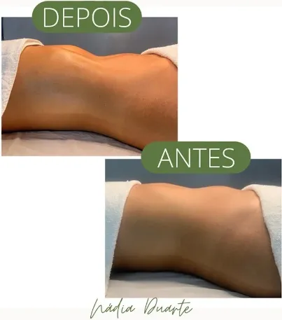 Imagem 4 da empresa NADIA DUARTE MASSOTERAPEUTA FORTALEZA
